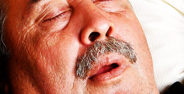 Sleep Apnea