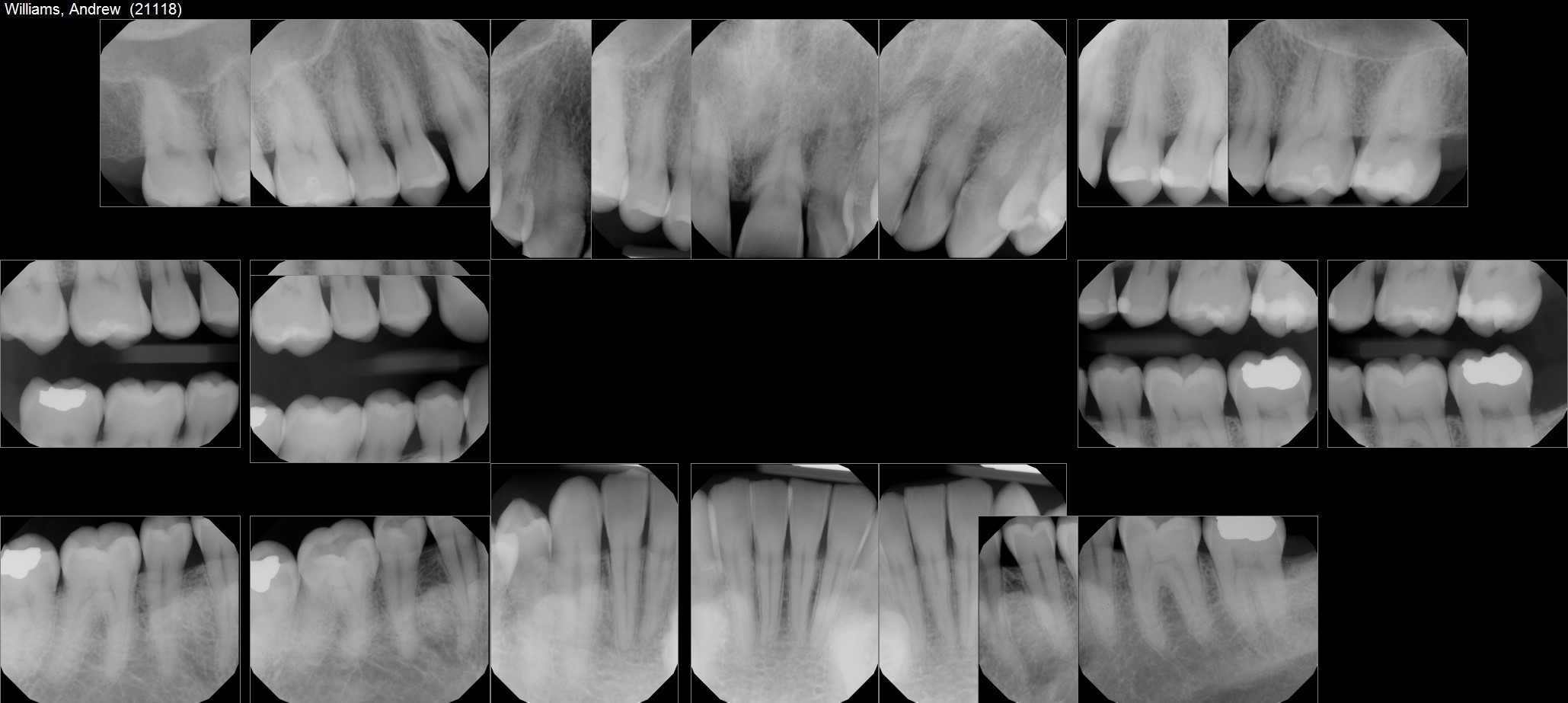 boynton_beach_dentist