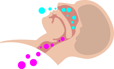 Sleep Apnea