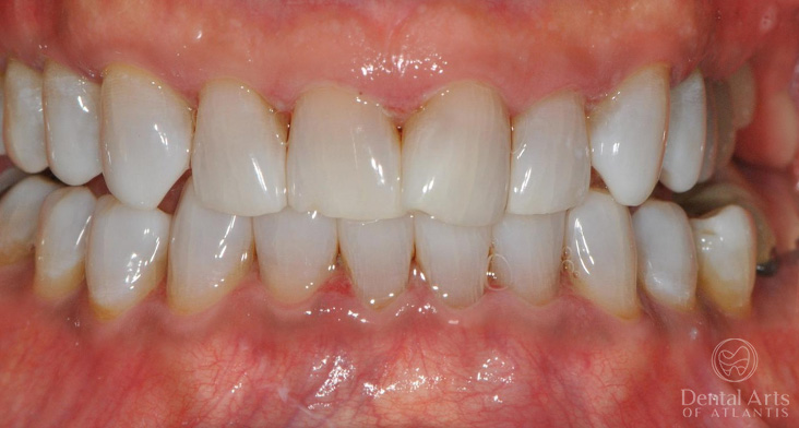 dental-arts-of-atlantis-unknown-after-2