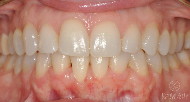 dental-arts-of-atlantis-unknown-after