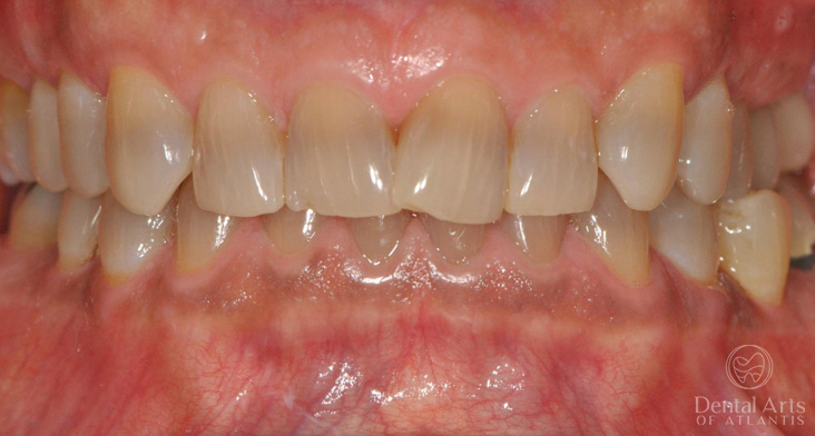 dental-arts-of-atlantis-unknown-before-2